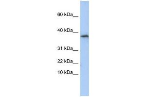 GLYAT antibody used at 1 ug/ml to detect target protein. (GLYAT 抗体  (N-Term))
