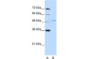 WB Suggested Anti-FOXQ1 Antibody Titration:  2. (FOXQ1 抗体  (N-Term))