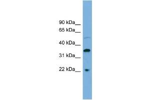 WB Suggested Anti-DOK6 Antibody Titration: 0. (DOK6 抗体  (Middle Region))