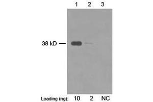 Primary antibody: 1 µg/mL Mouse Anti-Enterokinase Monoclonal Antibody (ABIN398568) Secondary antibody: Goat Anti-Mouse IgG (H&L) [HRP] Polyclonal Antibody (ABIN398387, 1: 20,000) The signal was developed with LumiSensorTM HRP Substrate Kit (ABIN769939) (TMPRSS15 抗体)