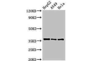 Western Blot Positive WB detected in: HepG2 whole cell lysate, A549 whole cell lysate, Hela whole cell lysate All lanes: ECH1 antibody at 2. (ECH1 抗体  (AA 36-135))