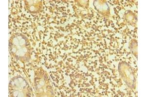 Immunohistochemistry of paraffin-embedded human small intestine tissue using ABIN7164899 at dilution of 1:100 (TAC1 抗体  (AA 1-129))