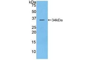 Detection of Recombinant DEP1, Mouse using Polyclonal Antibody to Density Enhanced Phosphatase 1 (DEP1) (PTPRJ 抗体  (AA 567-842))