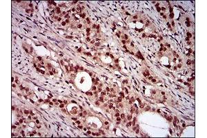 Immunohistochemistry (IHC) image for anti-Nibrin (NBN) (AA 467-615) antibody (ABIN1724942)