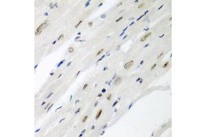 Immunohistochemistry of paraffin-embedded mouse heart using CDC27 antibody (ABIN5975347) at dilution of 1/200 (40x lens). (CDC27 抗体)