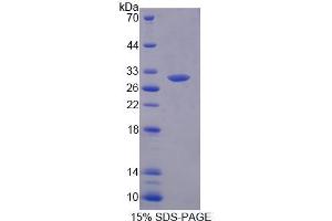 SDS-PAGE analysis of Human MED8 Protein. (MED8 蛋白)