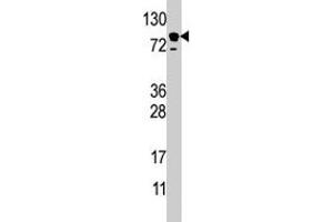Western blot analysis of EPS15 polyclonal antibody  in HL-60 cell line lysate (35 ug/lane). (EPS15 抗体  (C-Term))