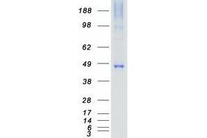 Western Blotting (WB) image for Mitogen-Activated Protein Kinase Kinase 7 (MAP2K7) protein (Myc-DYKDDDDK Tag) (ABIN2725395)