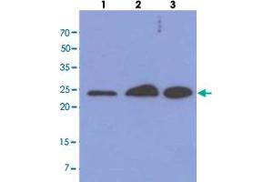 Western blot analysis of cell lysates (each 40 ug) by MRRF monoclonal antibody, clone AT7D10  (1:1000). (MRRF 抗体  (AA 56-262))