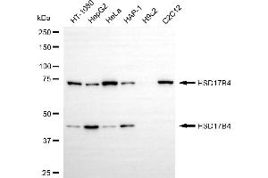 Western blotting analysis using HSD17B4 antibody (ABIN7799015). (HSD17B4 抗体)