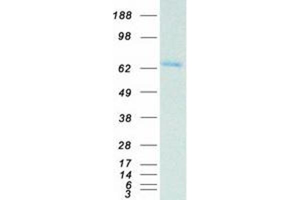 POT1 Protein (Transcript Variant 1) (Myc-DYKDDDDK Tag)