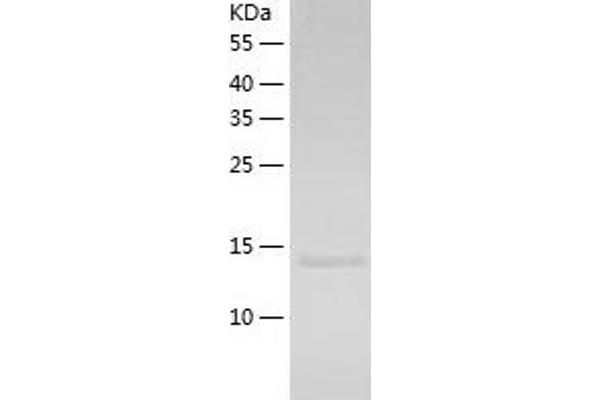 TRAF1 Protein (AA 266-416) (His tag)