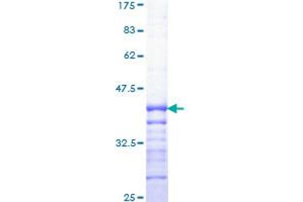 PKC alpha Protein (AA 563-672) (GST tag)