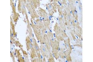 Immunohistochemistry of paraffin-embedded Rat heart using CCM2 Polyclonal Antibody at dilution of 1:100 (40x lens). (CCM2 抗体)