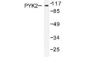 Image no. 1 for anti-PTK2B Protein tyrosine Kinase 2 beta (PTK2B) antibody (ABIN271907) (PTK2B 抗体)