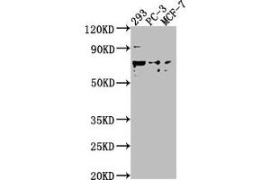 Western Blot Positive WB detected in: 293 whole cell lysate, PC-3 whole cell lysate, MCF-7 whole cell lysate All lanes: GPR37 antibody at 1:2000 Secondary Goat polyclonal to rabbit IgG at 1/50000 dilution Predicted band size: 68 kDa Observed band size: 68 kDa (GPR37 抗体  (AA 114-133))