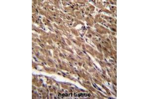 BTG3 Antibody (Center) immunohistochemistry analysis in formalin fixed and paraffin embedded human heart tissue followed by peroxidase conjugation of the secondary antibody and DAB staining. (BTG3 抗体  (Middle Region))