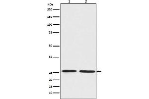 Western blot analysis of BNIP1 expression in (1) Jurkat cell lysate, (2) C6 cell lysate.