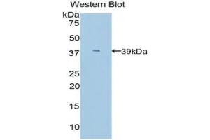 Western blot analysis of the recombinant protein. (APOC1 抗体  (AA 30-88))