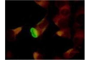 Immunofluorescence (IF) image for anti-Herpes Simplex Virus Type 2 ICP8 (HSV2 ICP8) antibody (ABIN265566) (HSV2 ICP8 抗体)