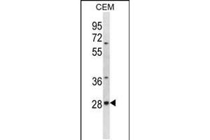 Western blot analysis in CEM cell line lysates (35ug/lane). (ALKBH4 抗体  (AA 88-117))