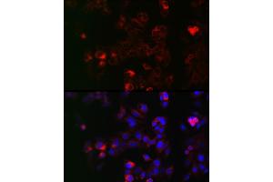 Immunofluorescence analysis of HepG2 cells using NOX1 Rabbit pAb (ABIN6133827, ABIN6144746, ABIN6144748 and ABIN6215916) at dilution of 1:50 (40x lens). (NOX1 抗体  (AA 200-300))