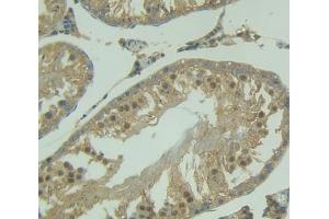 IHC-P analysis of Kidney tissue, with DAB staining. (NUP50 抗体  (AA 179-428))