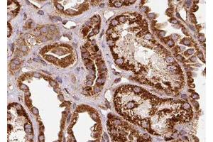 ABIN6278260 at 1/100 staining Human kidney tissue by IHC-P.