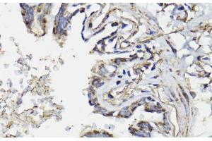Immunohistochemistry of paraffin-embedded Human lung using WASF3 Polyclonal Antibody at dilution of 1:100 (40x lens). (WASF3 抗体)