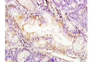 Formalin-fixed and paraffin embedded: rat colitis tissue labeled with Anti-PDGFRA Polyclonal Antibody, Unconjugated  at 1:200, followed by conjugation to the secondary antibody and DAB staining (PDGFRA 抗体  (AA 1021-1089))