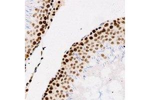 Immunohistochemical analysis of Importin alpha 1 staining in human testis formalin fixed paraffin embedded tissue section. (KPNA2 抗体)