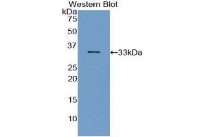 Western blot analysis of the recombinant protein. (IRAK2 抗体  (AA 235-521))