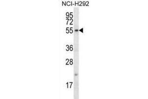 Western Blotting (WB) image for anti-F-Box Protein 15 (FBXO15) antibody (ABIN2996731) (FBXO15 抗体)