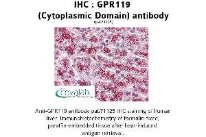 Image no. 2 for anti-G Protein-Coupled Receptor 119 (GPR119) (3rd Cytoplasmic Domain) antibody (ABIN1734912) (G Protein-Coupled Receptor 119 抗体  (3rd Cytoplasmic Domain))