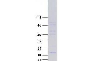 Western Blotting (WB) image for Aquaporin 1 (Colton Blood Group) (AQP1) (Transcript Variant 4) protein (Myc-DYKDDDDK Tag) (ABIN2714851)