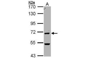 Western Blotting (WB) image for anti-Peptidyl Arginine Deiminase, Type IV (PADI4) (N-Term) antibody (ABIN2854478)