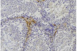 ABIN6276747 at 1/100 staining Mouse testis tissue by IHC-P.