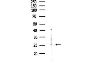 anti-Glutathione S-Transferase theta 1 (GSTT1) (N-Term) antibody