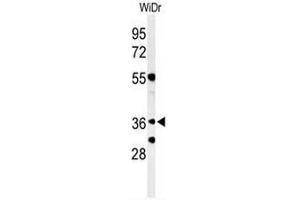 Western blot analysis of NSE4A Antibody (N-term) in WiDr cell line lysates (35µg/lane). (NSMCE4A 抗体  (N-Term))