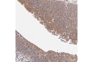 Immunohistochemical staining (Formalin-fixed paraffin-embedded sections) of human urinary bladder with ASB7 polyclonal antibody  shows moderate cytoplasmic positivity in urothelial cells. (ASB7 抗体)