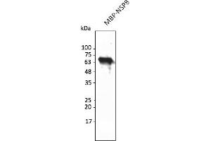 Western Blotting (WB) image for anti-SARS-CoV-2 Non-Structural Protein 8 (NSP8) antibody (ABIN7273001) (SARS-CoV-2 NSP8 抗体)