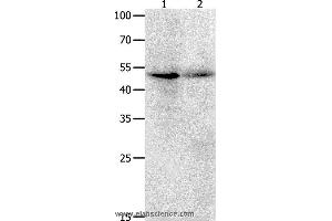 Western blot analysis of Jurkat cell  and human ovarian cancer tissue  , using KLF5 Polyclonal Antibody at dilution of 1:1700