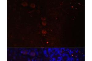 Immunofluorescence analysis of Rat brain using NEFM Polyclonal Antibody at dilution of 1:100. (NEFM 抗体)