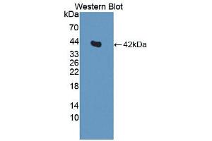 Western blot analysis of the recombinant protein. (Insulin 抗体  (AA 25-110))
