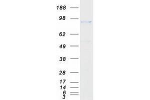 Western Blotting (WB) image for Protein Tyrosine Phosphatase Domain Containing 1 (PTPDC1) (Transcript Variant 1) protein (Myc-DYKDDDDK Tag) (ABIN2730097)