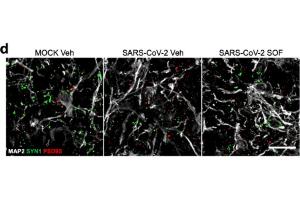 Immunolabeling of Synapsin 1 (SYN1) and PSD95-positive cells (green and red respectively) within MAP2+ neurons (white) in ight-week-old human brain cortical organoids (BCO) infected at MOI 2.