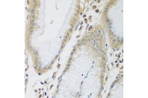 Immunohistochemistry of paraffin-embedded human stomach using ENPEP antibody at dilution of 1:200 (40x lens). (ENPEP 抗体)