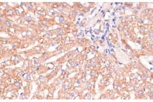 Immunohistochemistry of paraffin-embedded Rat liver using IKK alpha Polyclonal Antibody at dilution of 1:100 (40x lens). (IKK alpha 抗体)