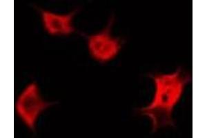 ABIN6266573 staining HeLa by IF/ICC. (KRT20 抗体  (C-Term))