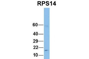 Western Blotting (WB) image for anti-Ribosomal Protein S14 (RPS14) (Middle Region) antibody (ABIN2778744)